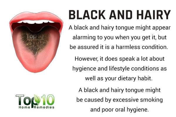 10 Secrets Your Tongue Reveals About Your Health Top 10 Home Remedies