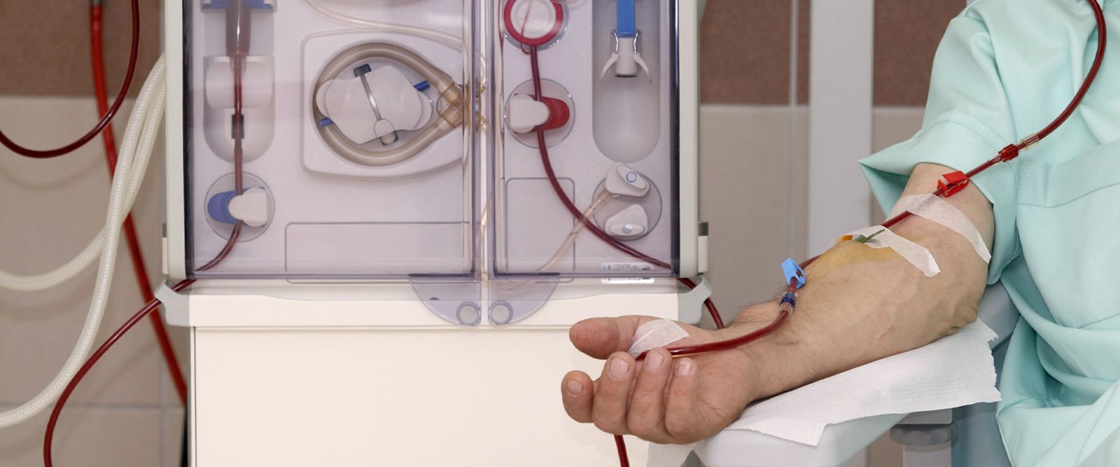 Does Dialysis Destroy Your Heat: Myths, Risks, And Coping Tips For Patients