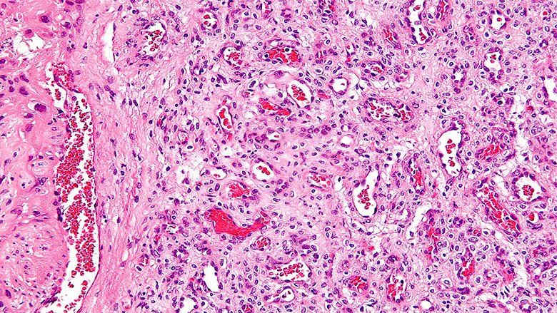 Eclosion Muscles Secrete Ecdysteroids To Initiate Asymmetric Intestinal Stem Cell Division In Drosophila Developmental Cell
