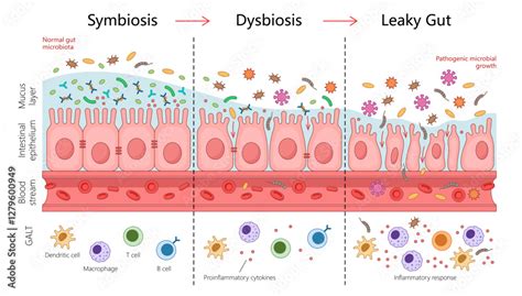 Is Leaky Gut Real The Science Of Intestinal Permeability