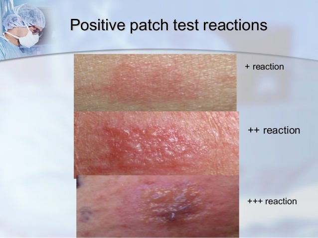 The Future Of Manuel Valtierra Atopy Reports: Trends And Breakthroughs