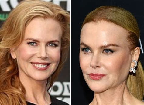 Nicole Kidman Amp 39 S Amp Quot Unrecognizable Amp Quot Face Leaving Fans Worried What Amp 39 S Happening To Her Face Marca Nicole Kidman Amp 39 S Amp Quot Unrecognizable Amp Quot Face Leaving Fans Worried What Amp 39 S Happening To Her Face Marca