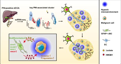 Single Cell Analysis Reveals That Gfap Dedifferentiated Schwann Cells Promote Tumor Progress In Pni Positive Distal Cholangiocarcinoma Via Lactate Hmgb1 Axis Cell Death Disease