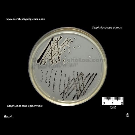 Staphylococcus Epidermidis Temperature In Incubator: Lab Guidelines